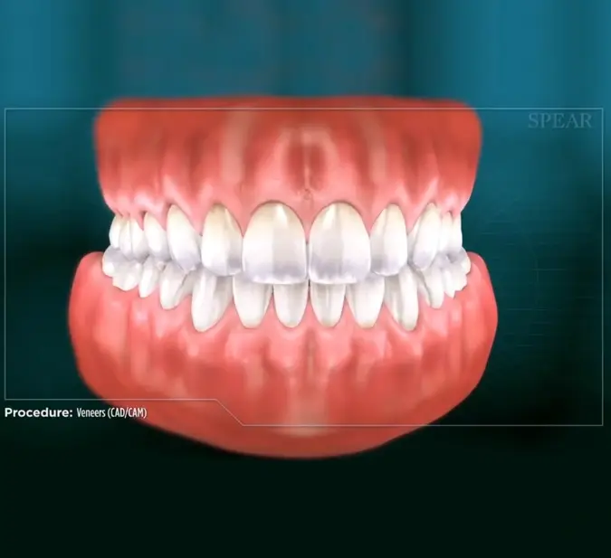 Personalized smile design illustration