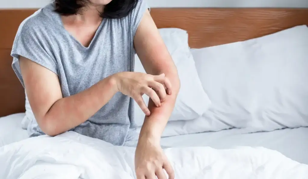 Person on bed scratching red, irritated welts on forearm and upper arms consistent with bed bug bites