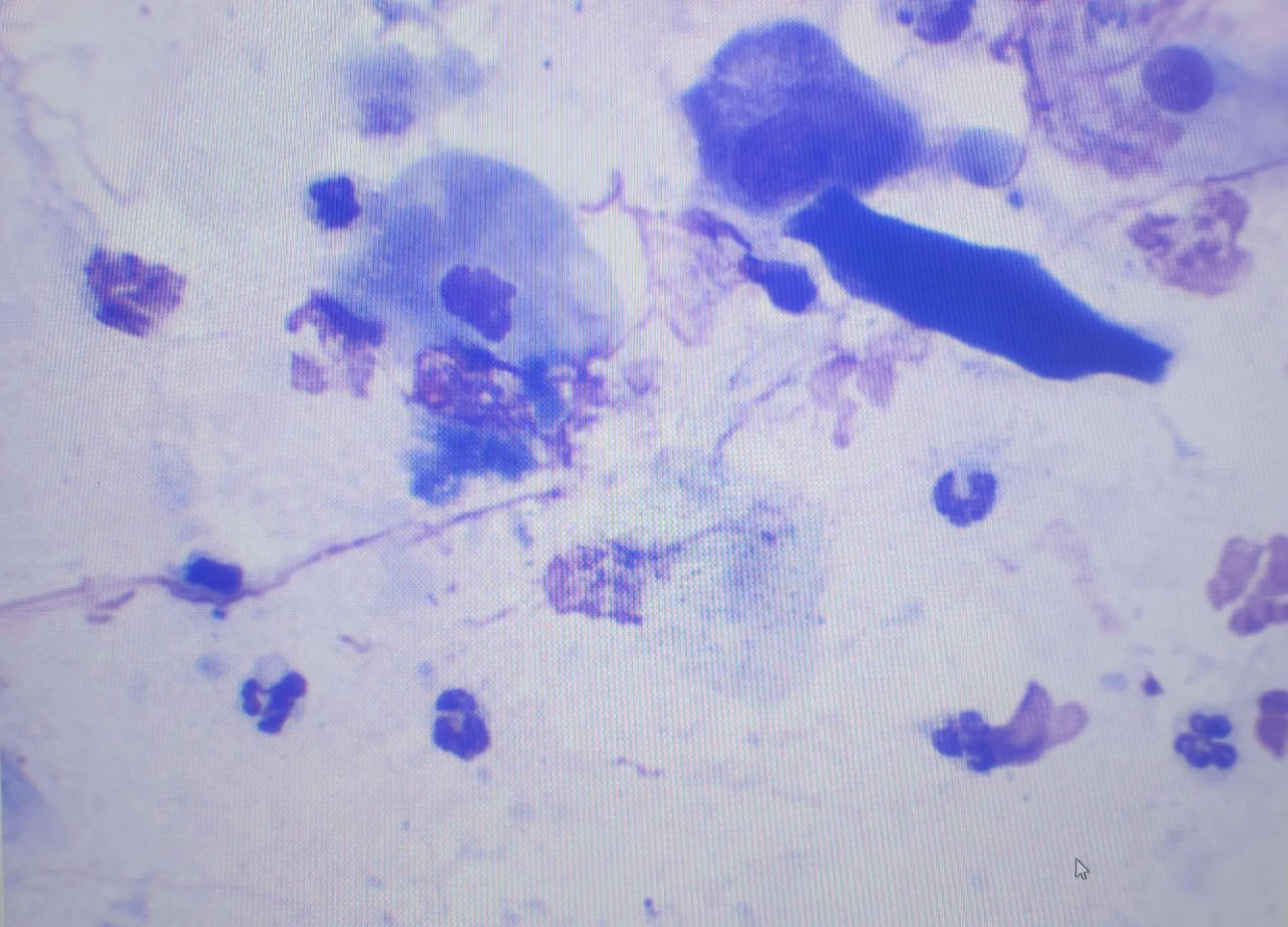 microscope swab stock photo