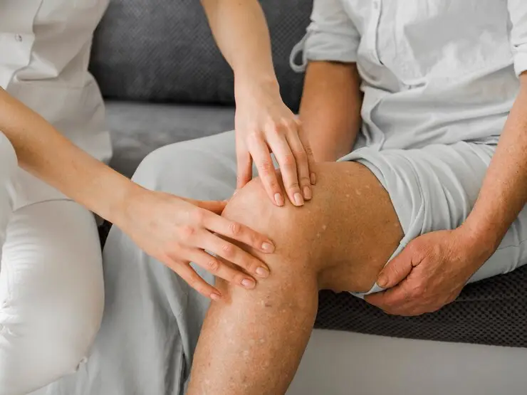 Varicose veins