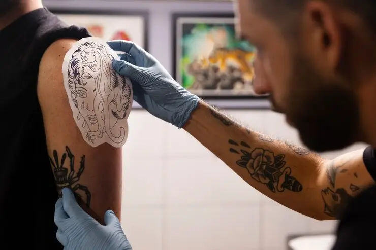 Tattoo Removal