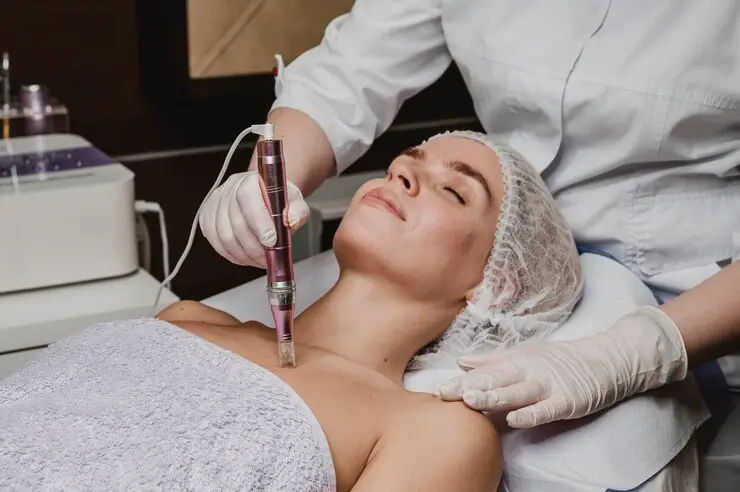 Laser Resurfacing
