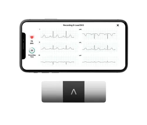 Best Portable ECG Monitors 4 KardiaMobile 6-Lead Personal EKG Monitor