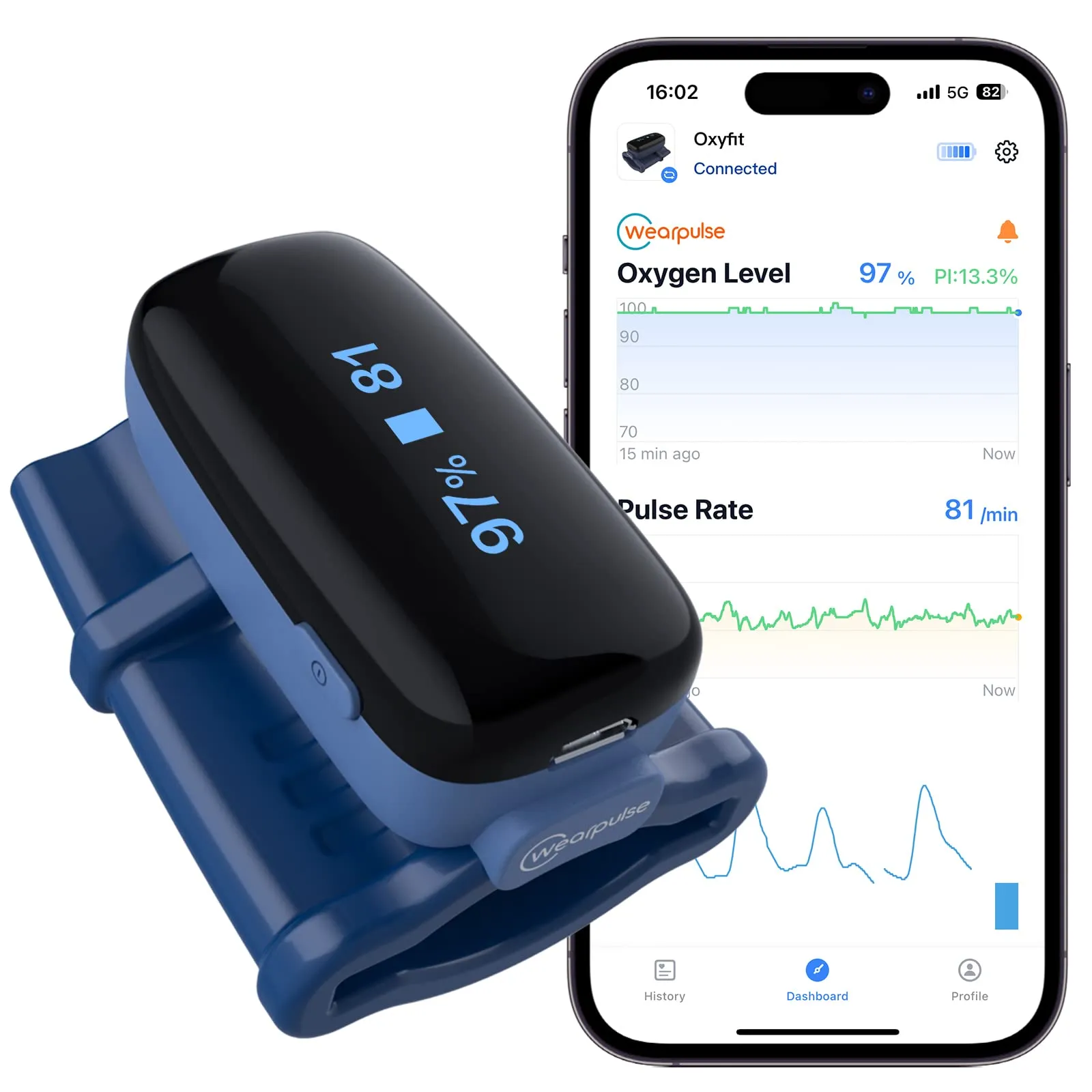 Overnight Oximeter: Top 5 Devices for Sleep Monitoring in 2024 5 Overnight Oximeter: Top 5 Devices for Sleep Monitoring in 2024 blood oxygen