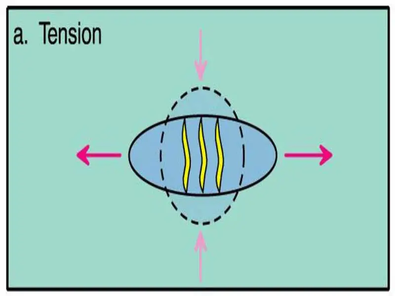 Tension