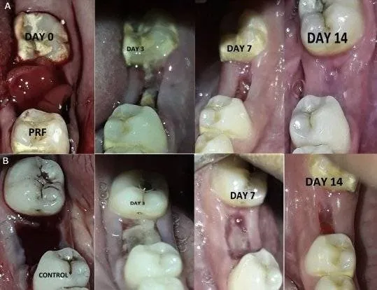 healing pictures day by day stages