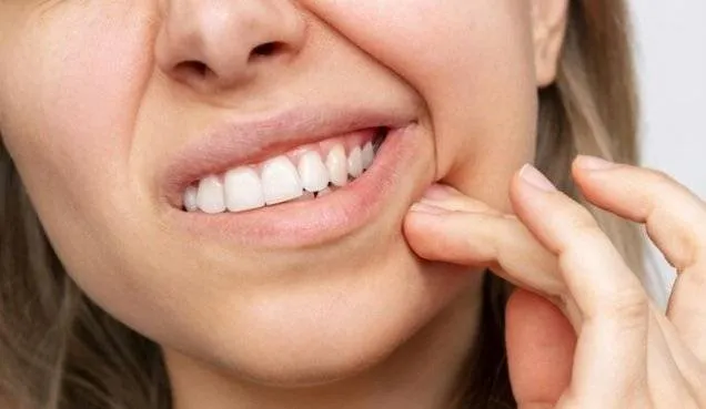 Wisdom Tooth Cutting Into Cheek: Relief & Solutions (2026)