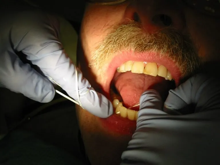 Is Gingivitis Contagious? What You Need to Know