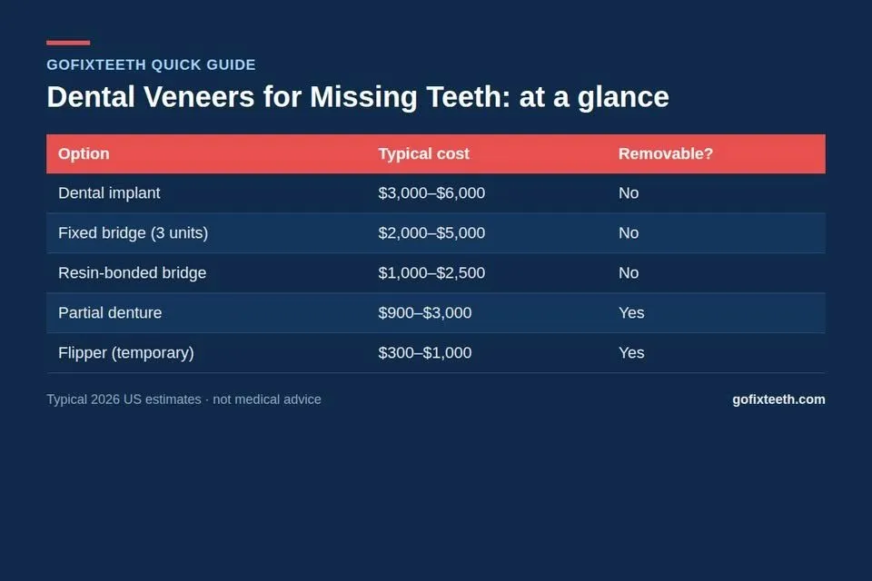 Dental Veneers for Missing Teeth at a glance