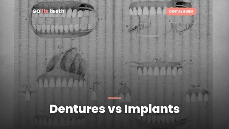 Dentures vs Implants: Cost, Comfort and Which Is Better