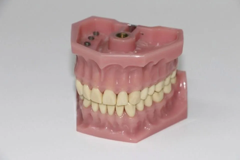Full upper and lower dentures on a model