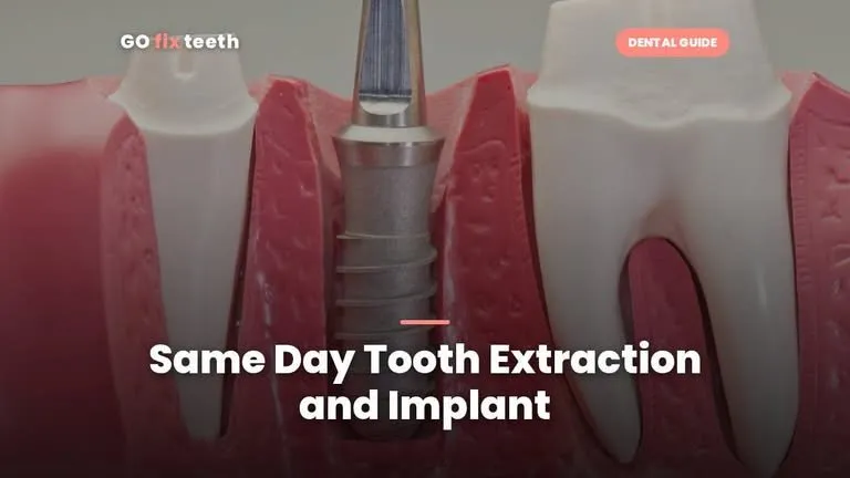 Same Day Tooth Extraction and Implant: Is It Right for You?