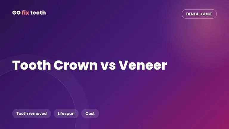 Tooth Crown vs Veneer: Differences, Cost and Lifespan
