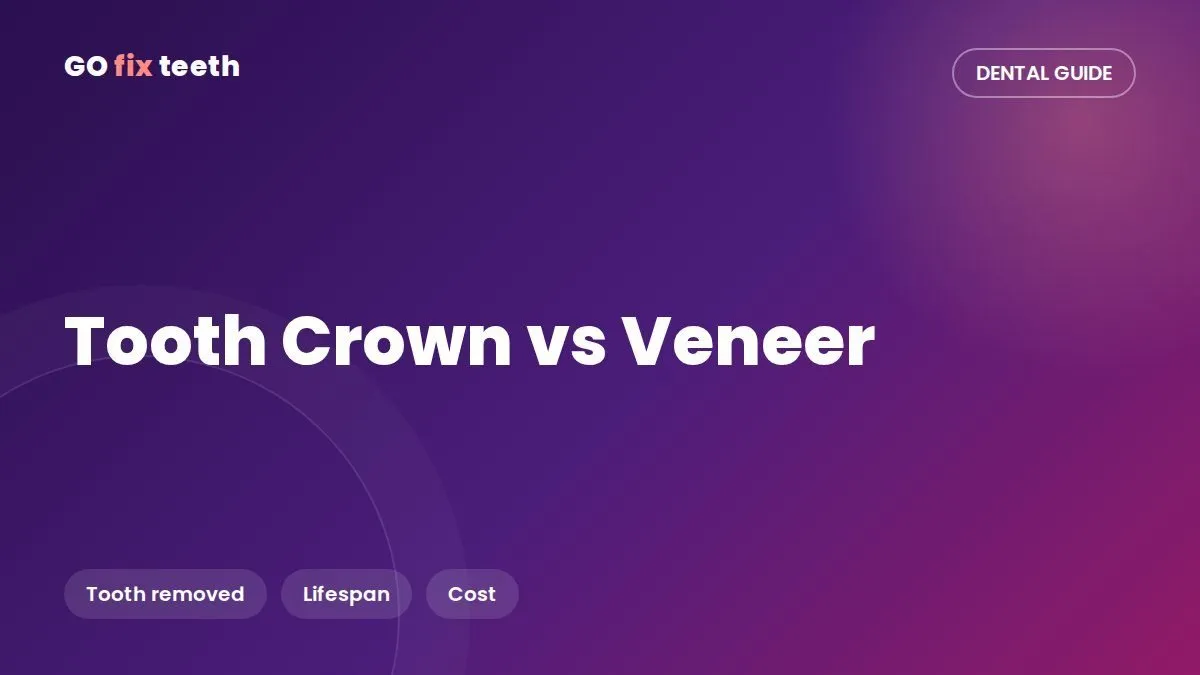Tooth Crown vs Veneer: Differences, Cost and Lifespan