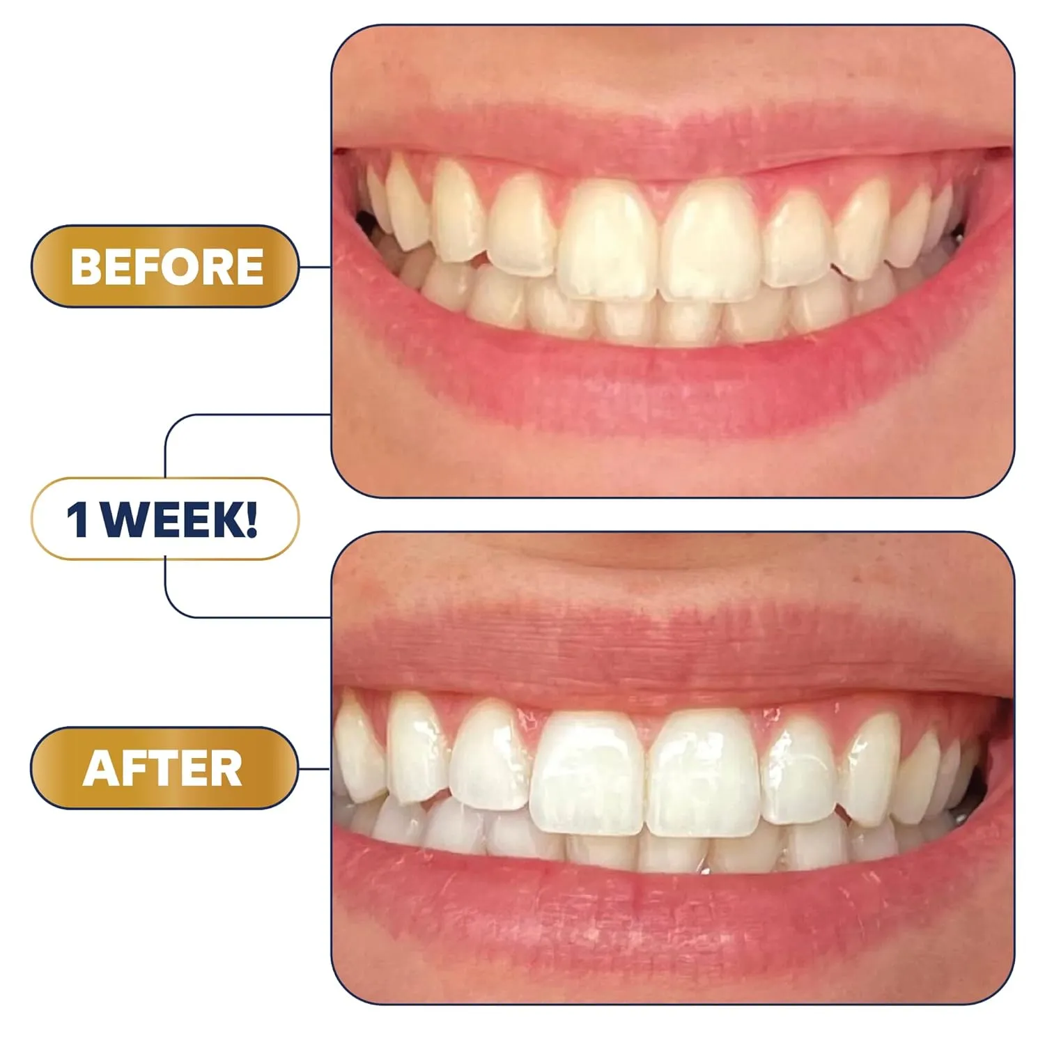 Lumineux Whitening Strips