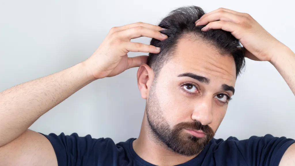 Man with Hair Issues