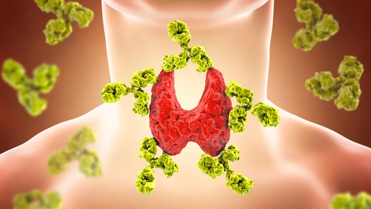 Thyroid Supplements for Weight Loss - Thyroid Hormone