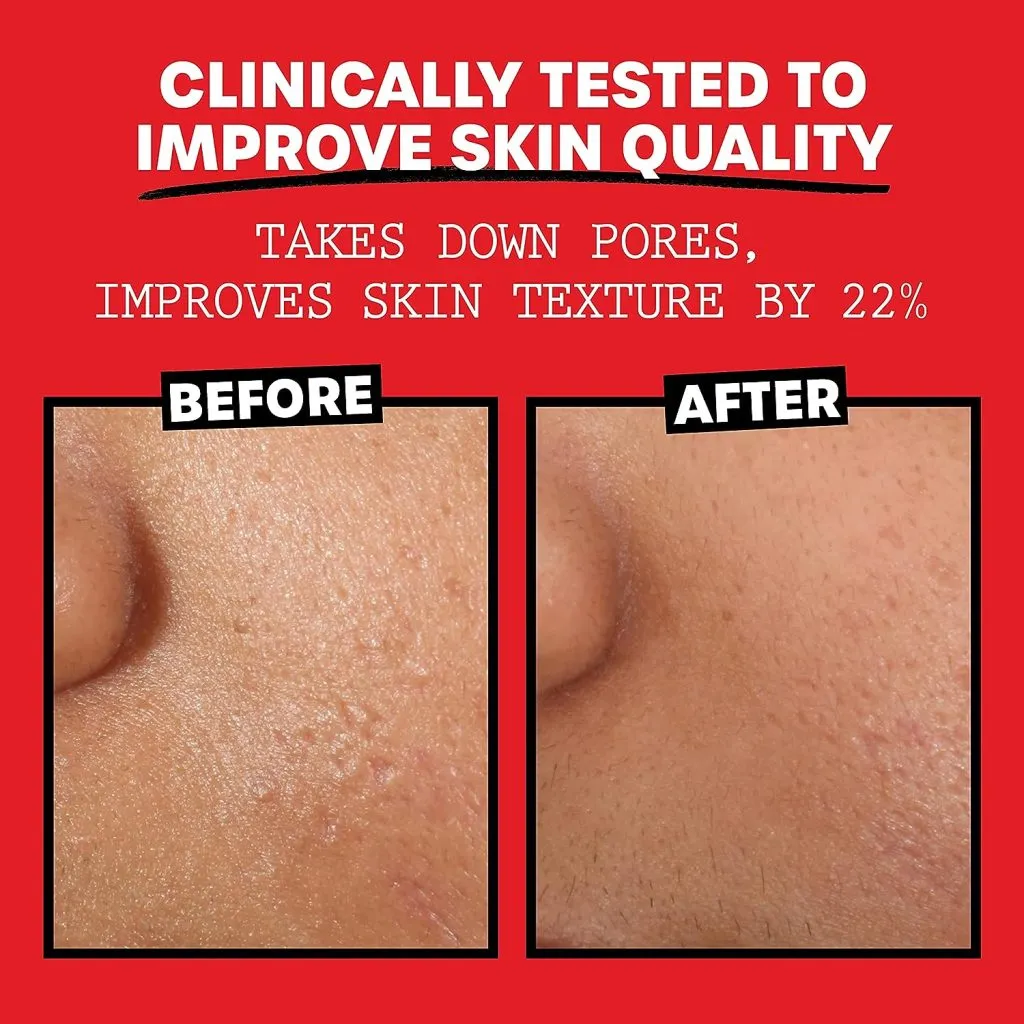 Thayers Alcohol-Free, Hydrating Rose Petal Witch Hazel Facial Toner with Aloe Vera Formula -4