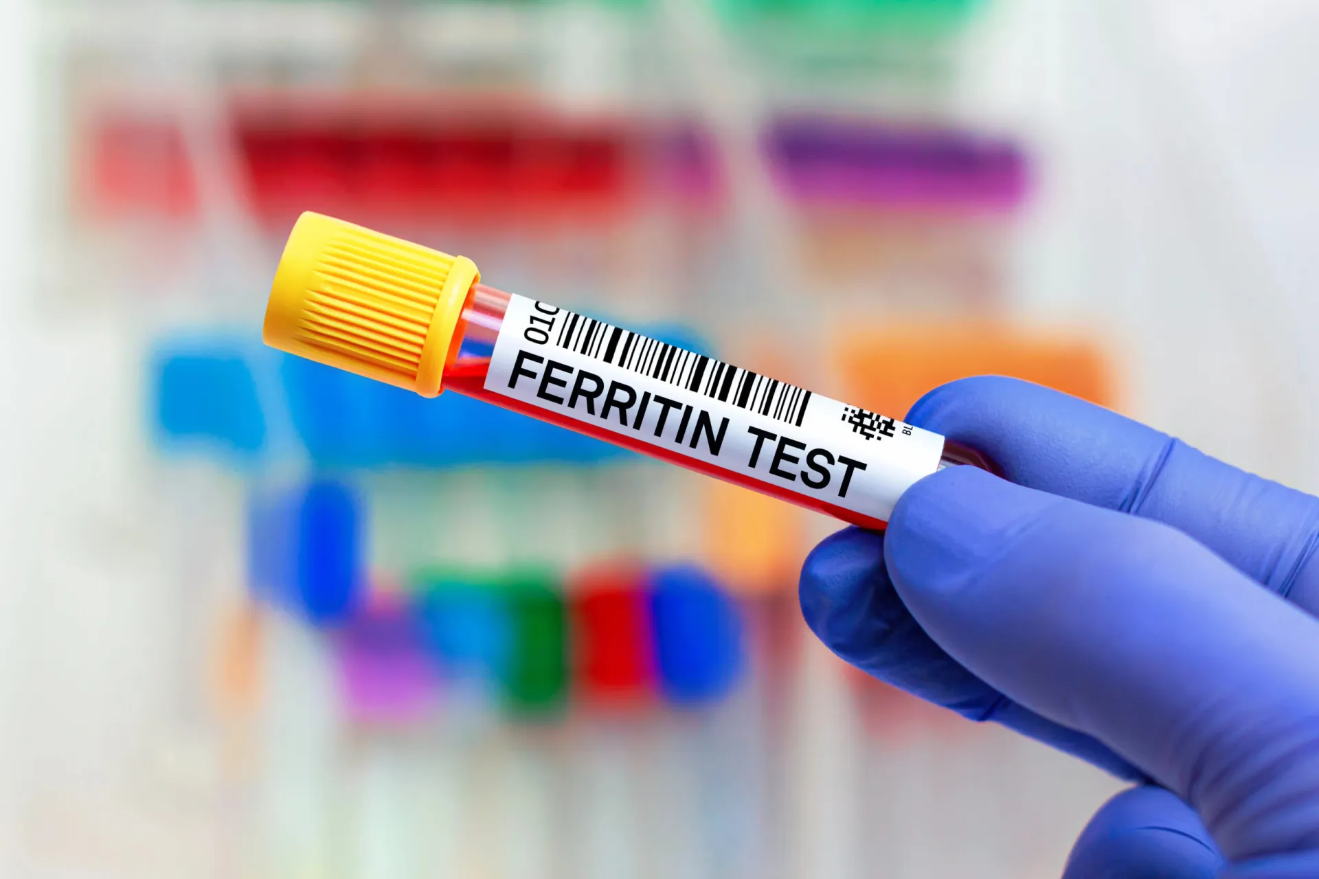 Eine behandschuhte Hand hält ein Blutprobenröhrchen mit der Aufschrift „FERRITIN-TEST“, was die Wichtigkeit der Überprüfung des Ferritinspiegels unterstreicht. Im Hintergrund sind weitere Reagenzgläser unscharf zu sehen.