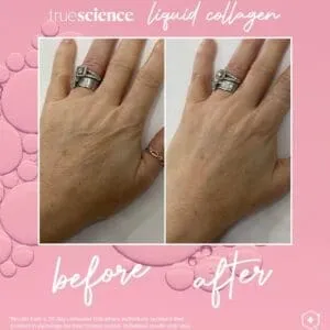 Collagen Visible Benefits Assets_Visible Results-12