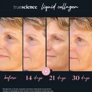 Collagen Visible Benefits Assets_Visible Results-13
