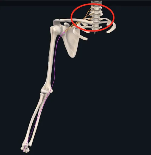 Brachial Plexus circled in red