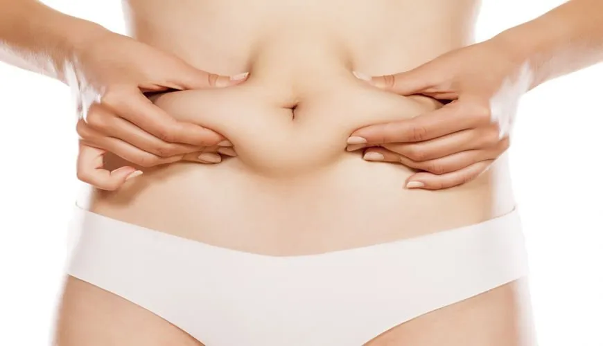 Tummy tuck