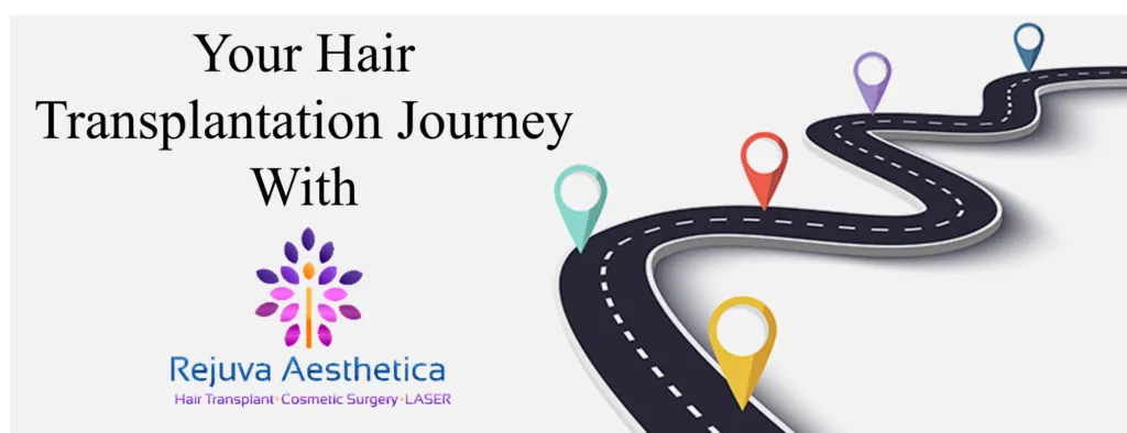 Steps in Hair Transplant,Hair Transplant Journey