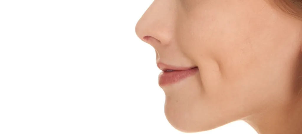 Dimple Creation Cost