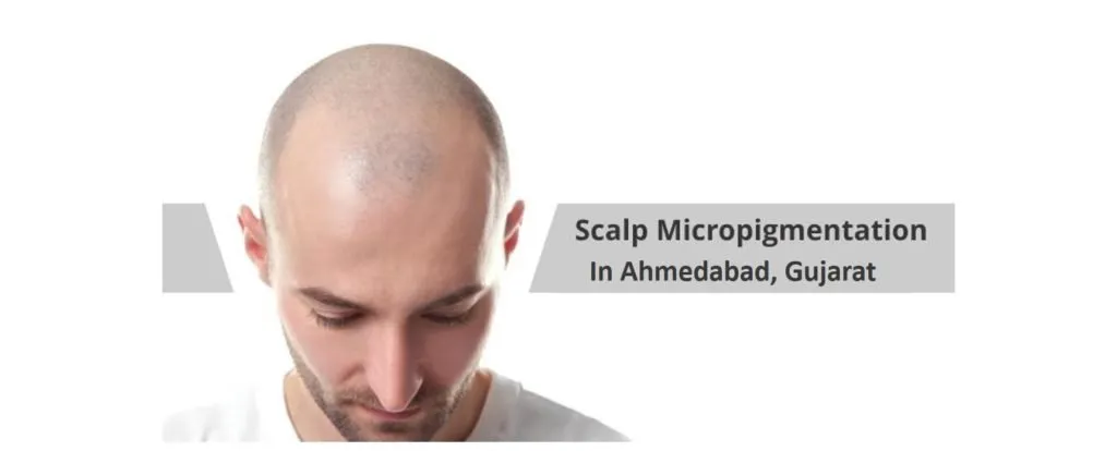 Hair Tattoo Treatment