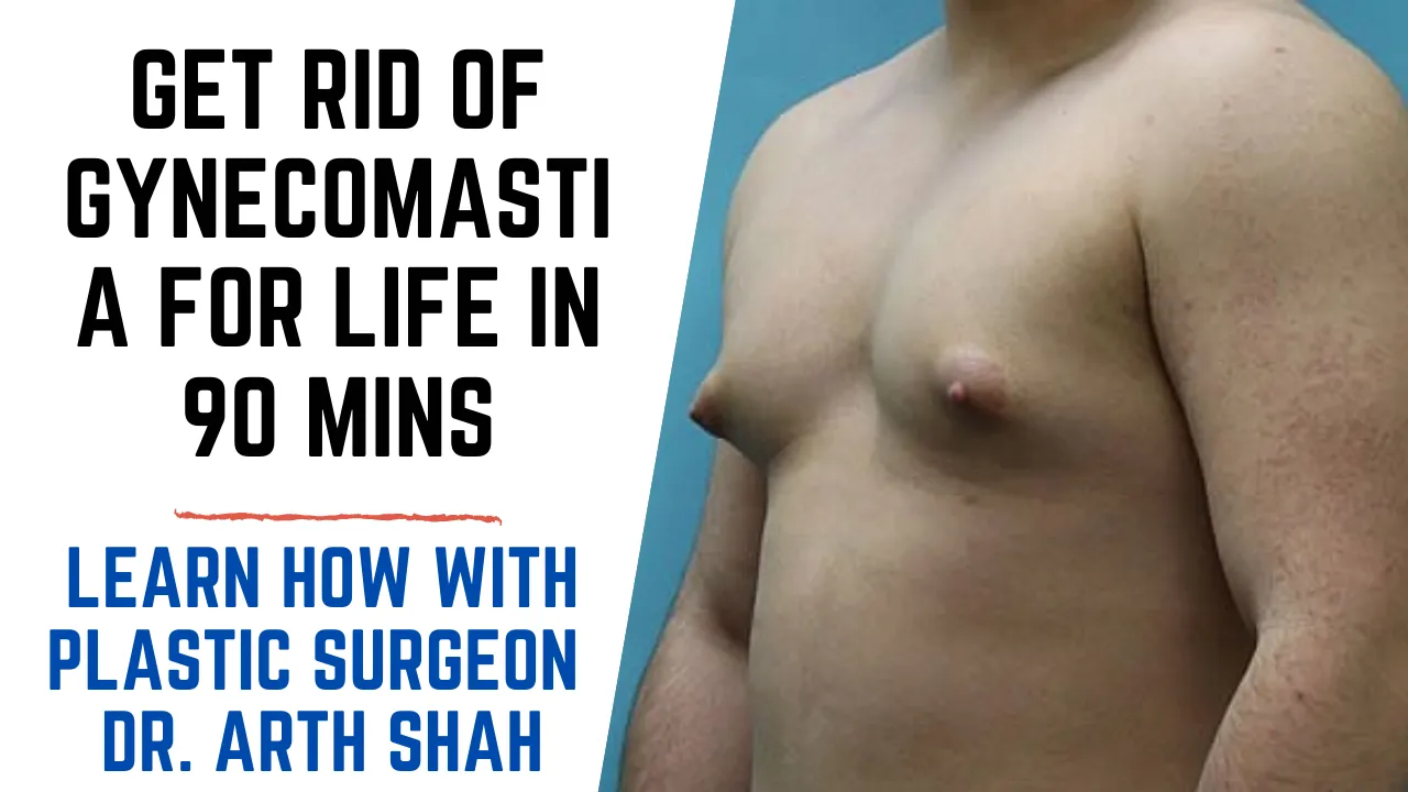 Gynecomastia Treatment in Gujarat,India