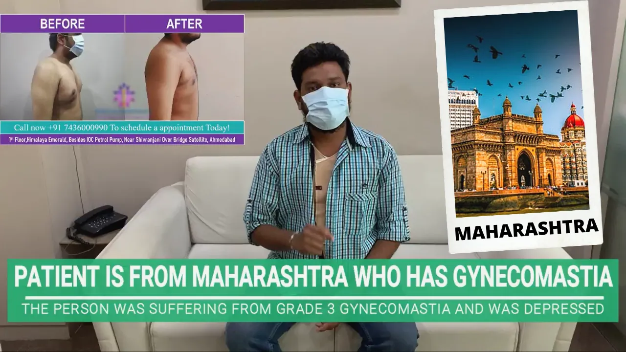GYNECOMASTIA PATIENT FROM MAHARASHTRA SHARING HIS EXPERIENCE OF GYNECOMASTIA SURGERY WITH DR SHAH