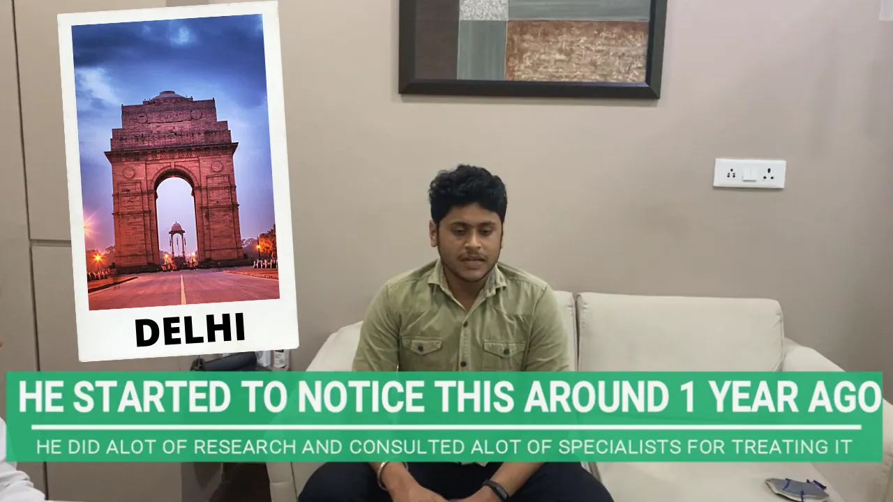 GYNECOMASTIA PATIENT FROM DELHI CAME TO AHMEDABAD TO GET TREATED FOR GYNECOMASTIA SURGERY IN INDIA.