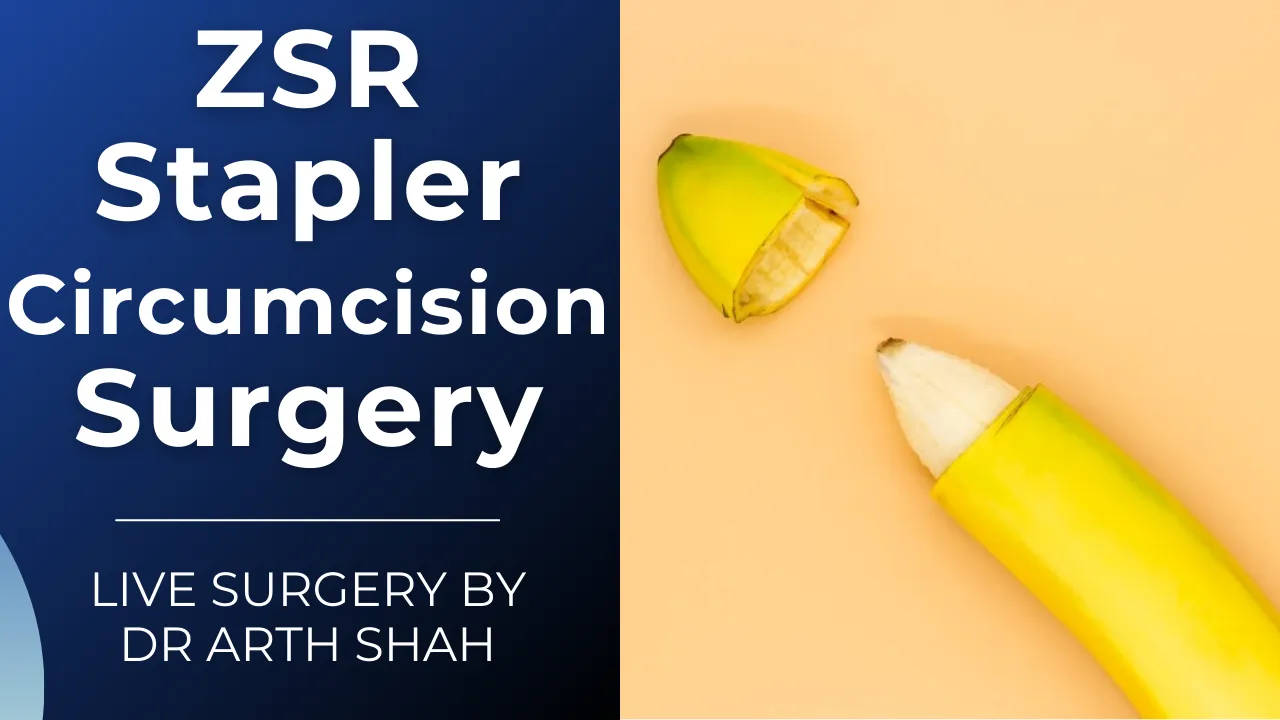 Stapler Circumcision Treatment in Ahmedabad at no Cost EMI