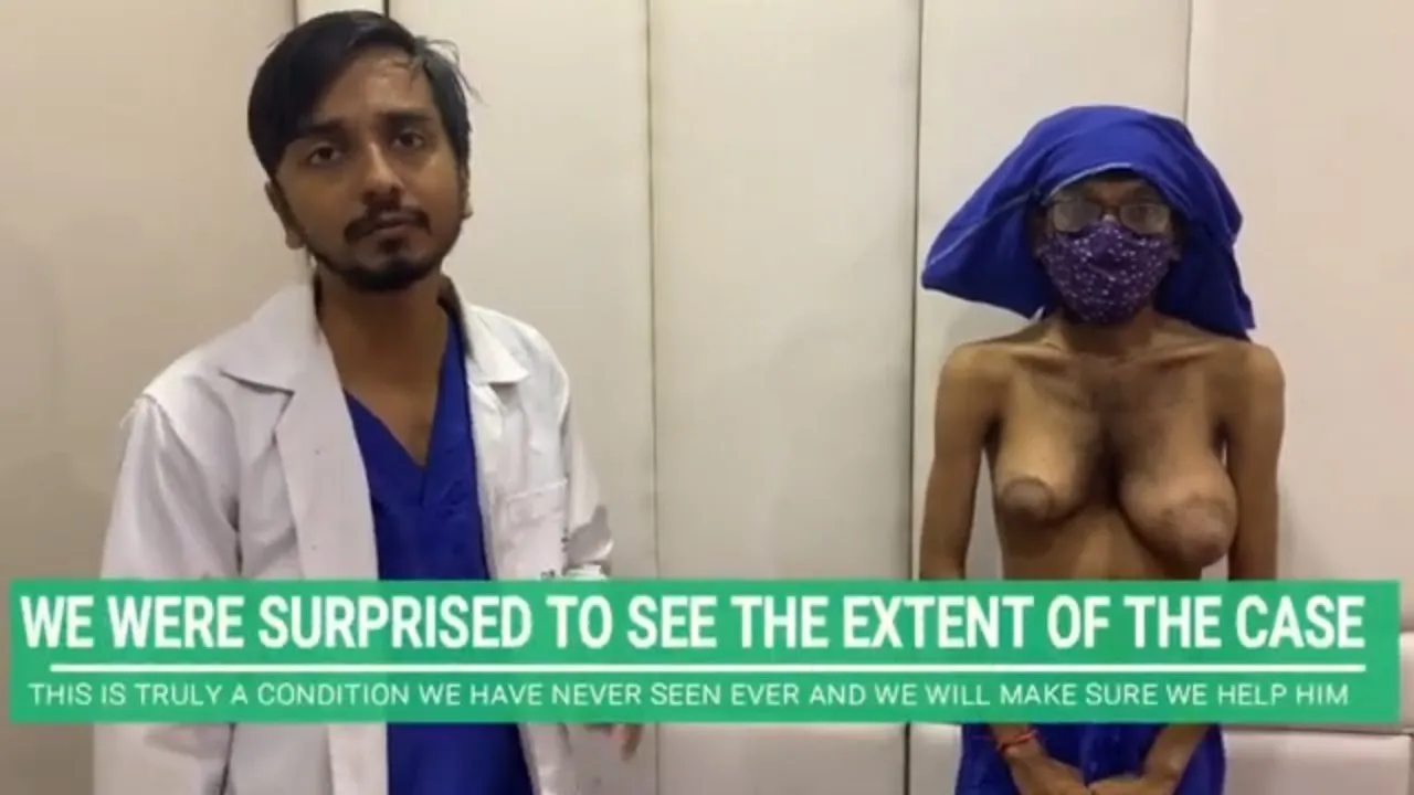 Unbelievable Gynecomastia (Male Breast Enlargement) Case we have ever seen