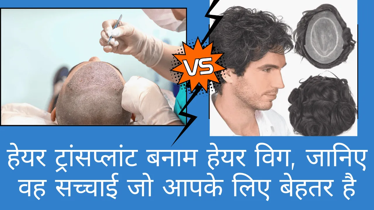 Hair Transplant or Hair Wig which is better for you