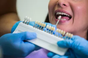 Long-Term Oral Health Benefits of Dental Bridges
