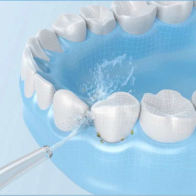 זרם סילון לשיניים נטען חדש מבית שיאומי – Xiaomi Mijia Mi Oral – תמונה 3