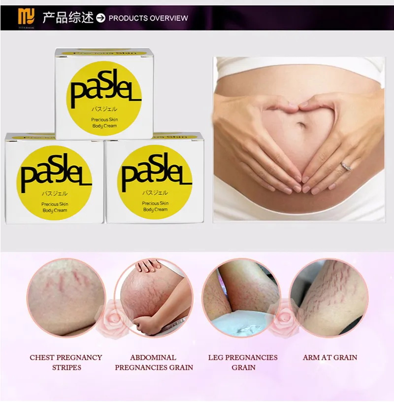 קרם להעלמת סימני מתיחה מבית PASJEL קרם להעלמת סימני מתיחה מבית PASJEL