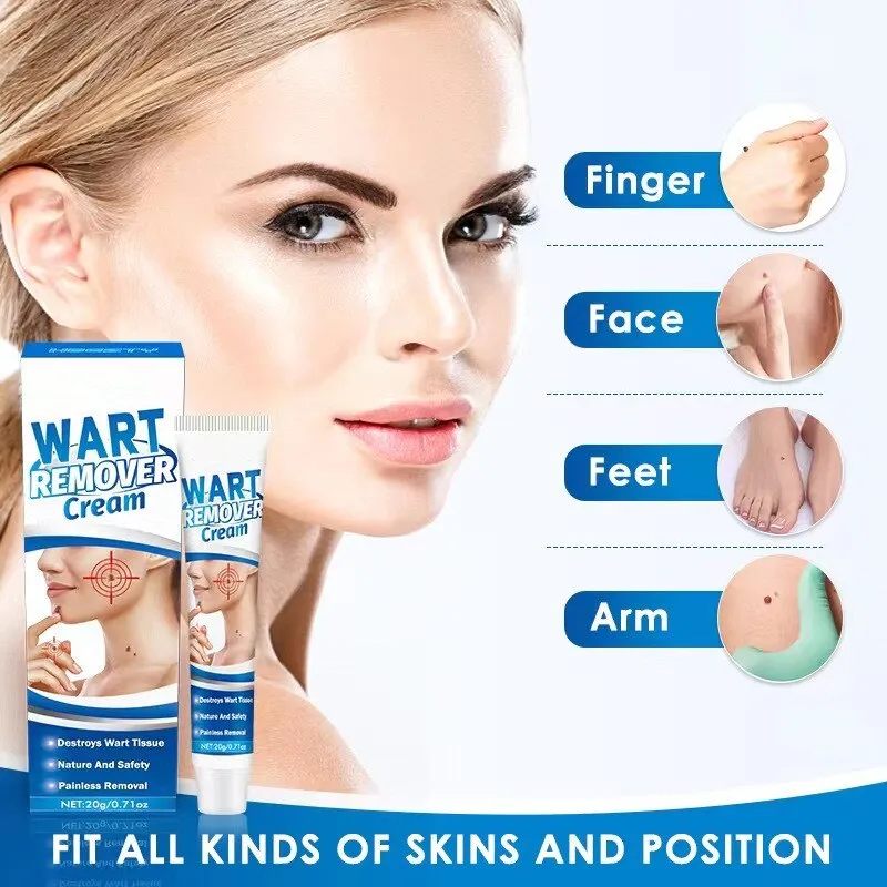 ⁦משחה להסרת שומות וסרחי עור WART⁩ – תמונה ⁦2⁩