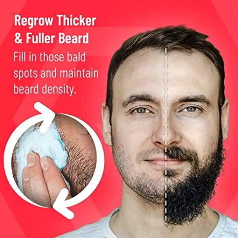 ⁦Regenivade - מינוקסידיל 5% קצף + ביוטין אספקה לשישה חודשים - התכשיר המתקדם ביותר!⁩ – תמונה ⁦5⁩