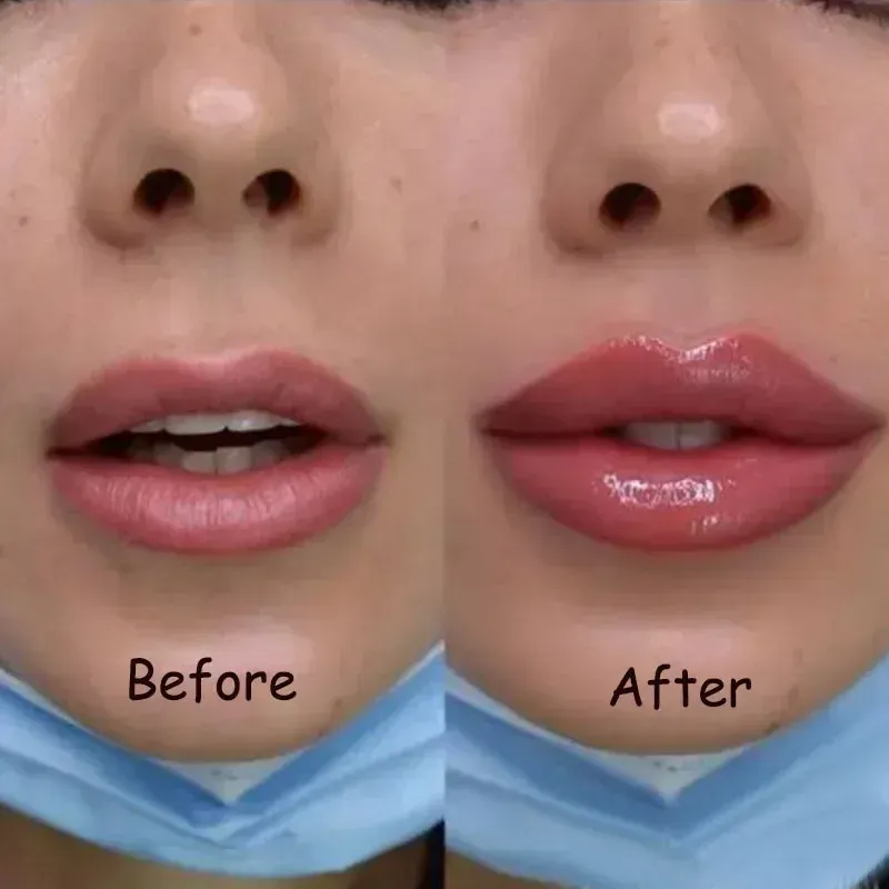 Lip Plumping Serum Increase Lip Elasticity Reduce Fine Lines Instant Plump Repair Nourishing Essential Oils Sexy Beauty Lip Care Lip Plumping Serum Increase Lip Elasticity Reduce Fine Lines Instant Plump Repair Nourishing Essential Oils Sexy Beauty Lip Care