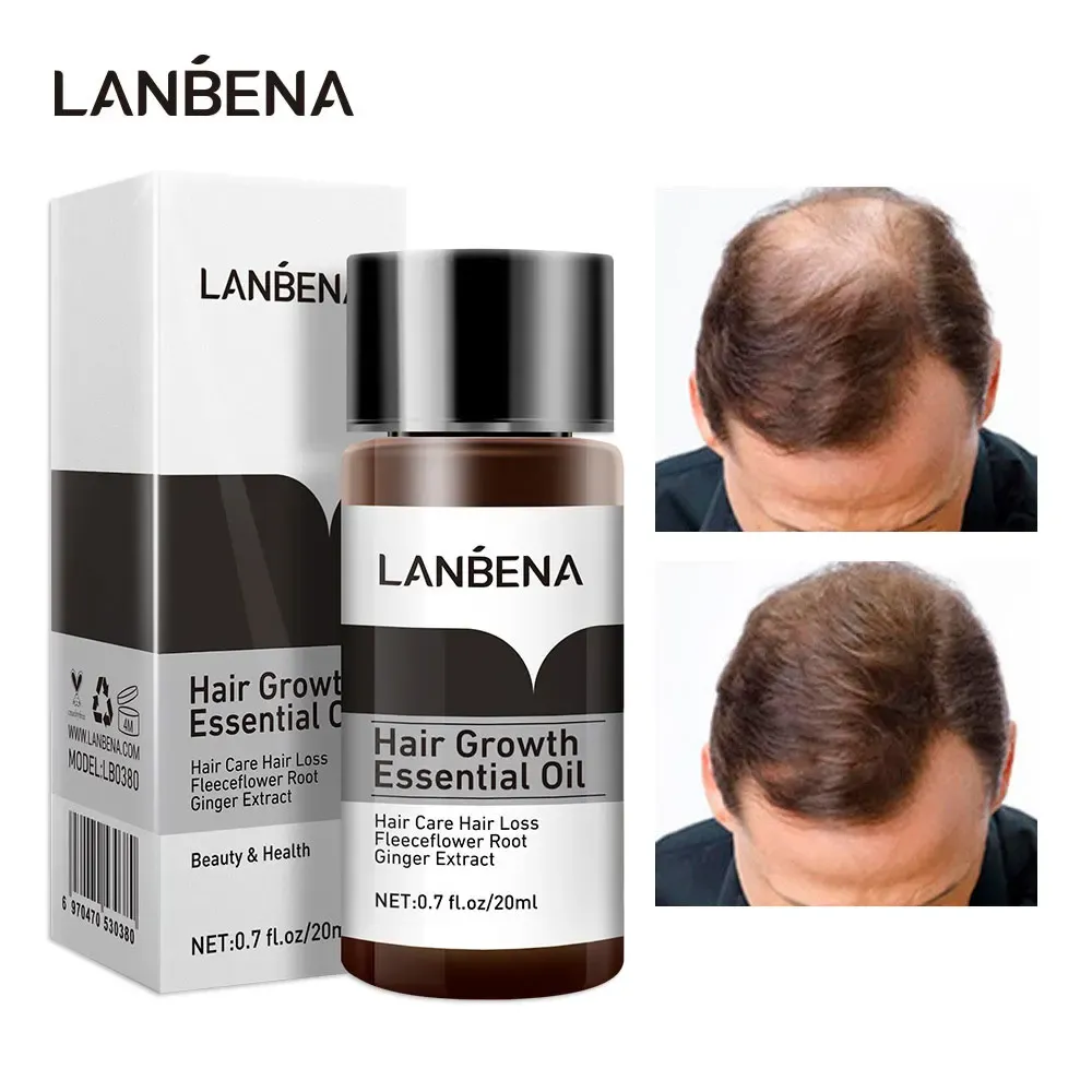 שמן לצמיחת שיער - LANBENA – תמונה 5