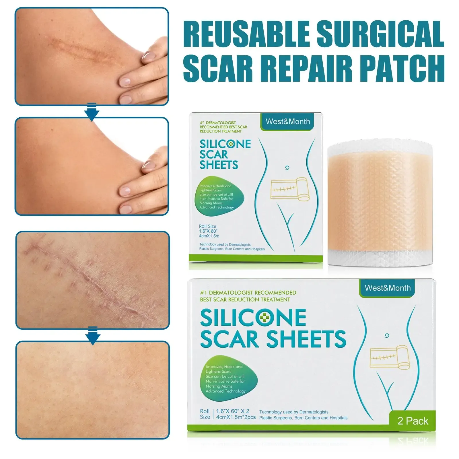 Silicone Scar Patch Skin Repair Sheets Removal Self-Adhesive Stretch Mark Tape Therapy Patch Burn Acne Scar Skin Care Silicone Scar Patch Skin Repair Sheets Removal Self-Adhesive Stretch Mark Tape Therapy Patch Burn Acne Scar Skin Care