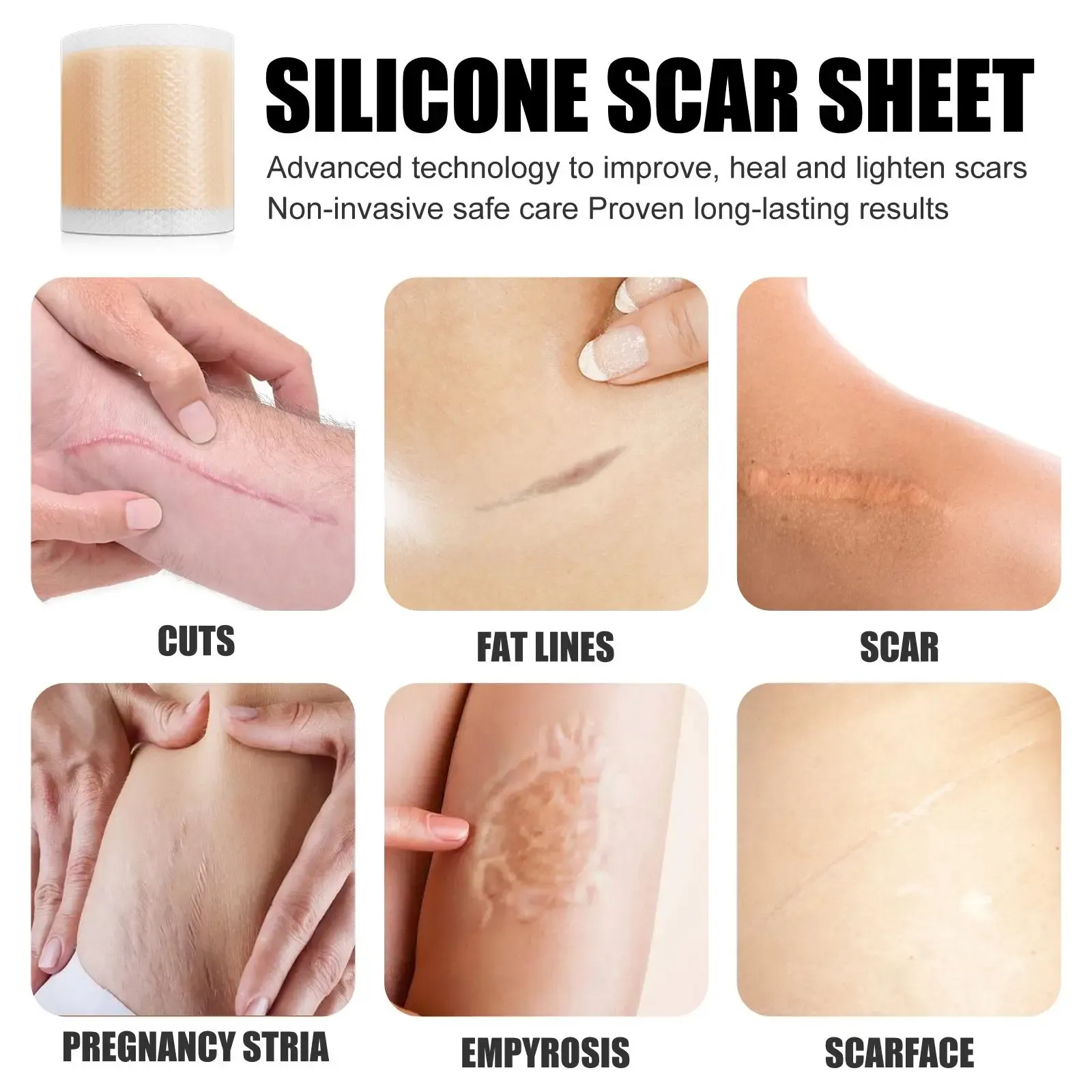 Silicone Scar Patch Skin Repair Sheets Removal Self-Adhesive Stretch Mark Tape Therapy Patch Burn Acne Scar Skin Care Silicone Scar Patch Skin Repair Sheets Removal Self-Adhesive Stretch Mark Tape Therapy Patch Burn Acne Scar Skin Care