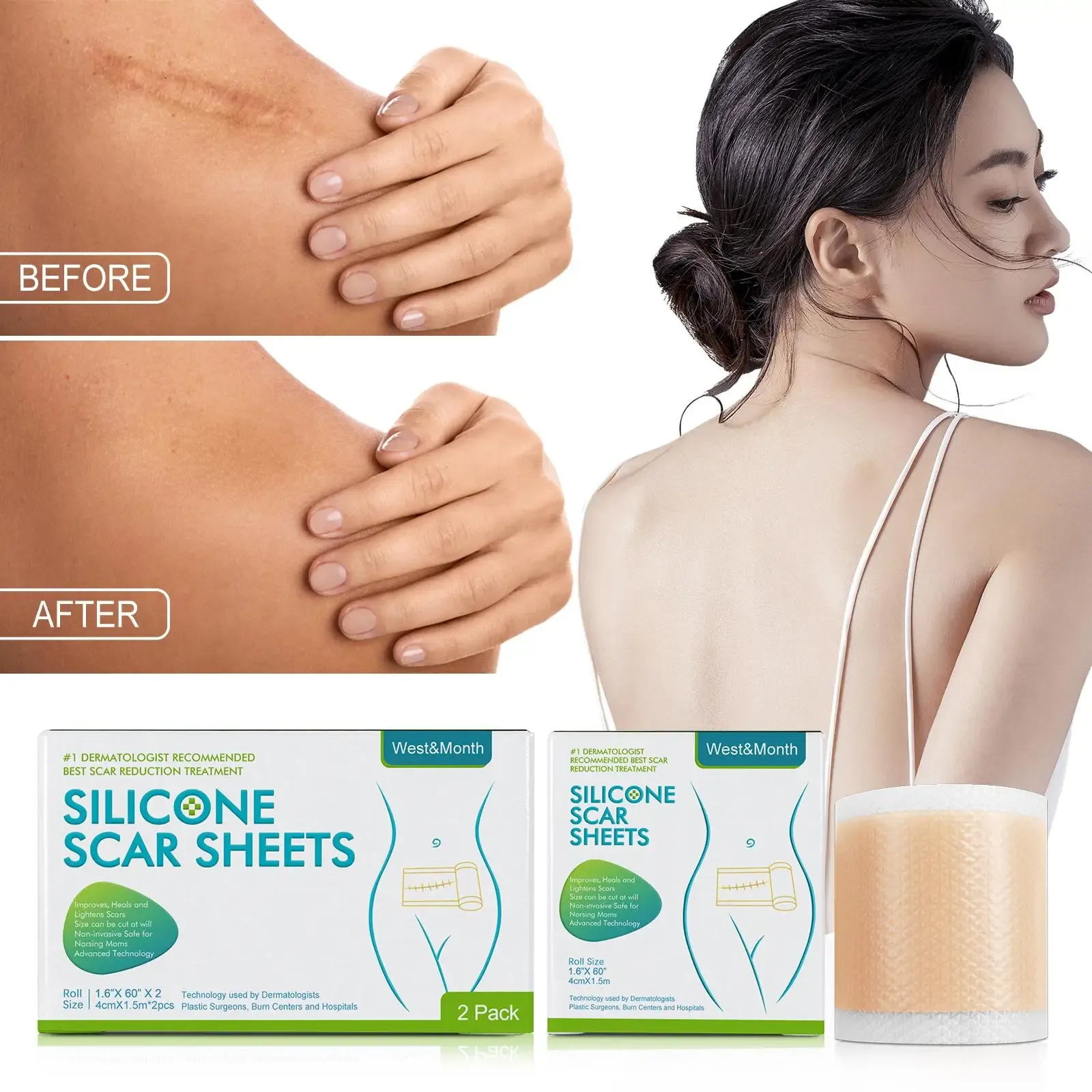 Silicone Scar Patch Skin Repair Sheets Removal Self-Adhesive Stretch Mark Tape Therapy Patch Burn Acne Scar Skin Care Silicone Scar Patch Skin Repair Sheets Removal Self-Adhesive Stretch Mark Tape Therapy Patch Burn Acne Scar Skin Care