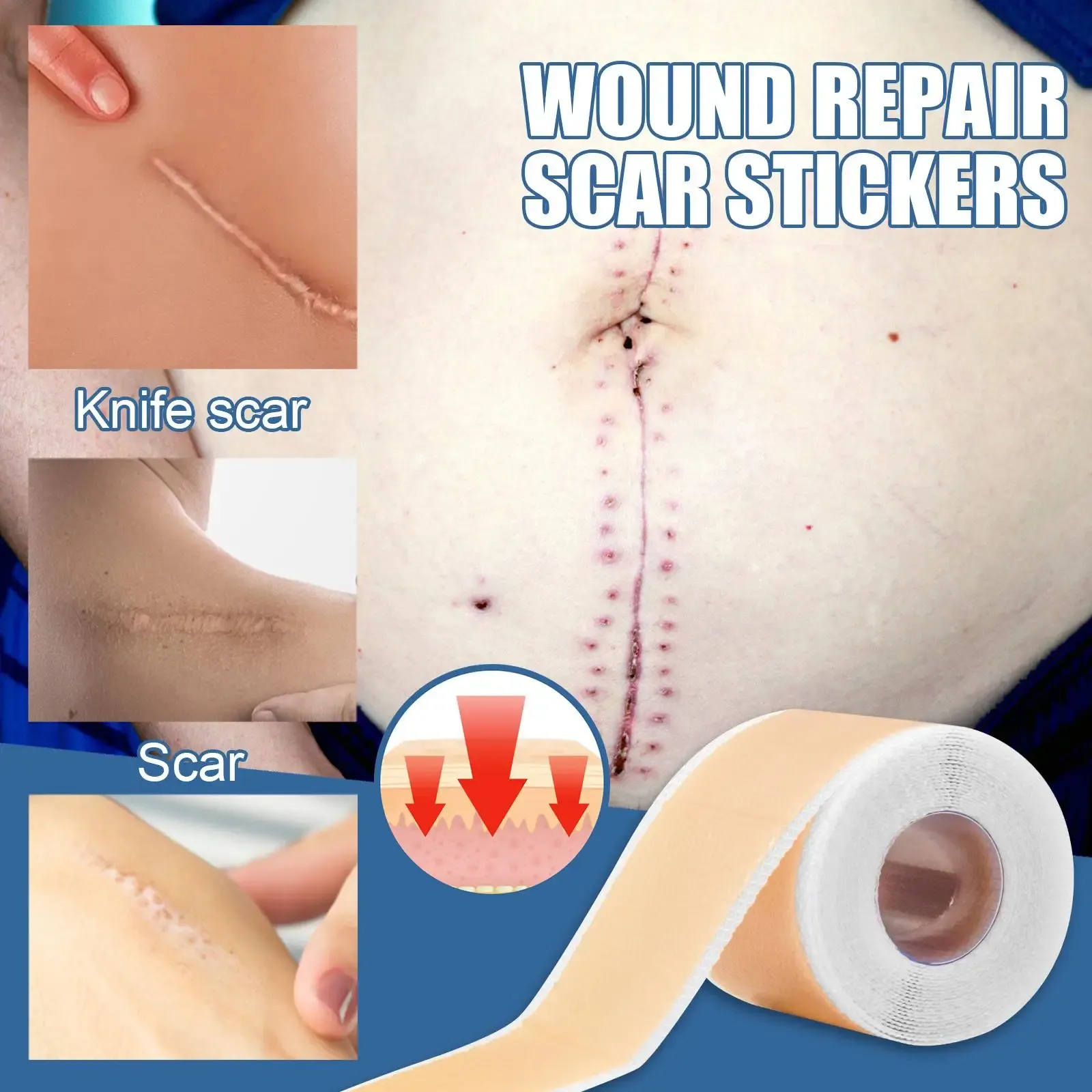 Silicone Scar Patch Skin Repair Sheets Removal Self-Adhesive Stretch Mark Tape Therapy Patch Burn Acne Scar Skin Care Silicone Scar Patch Skin Repair Sheets Removal Self-Adhesive Stretch Mark Tape Therapy Patch Burn Acne Scar Skin Care
