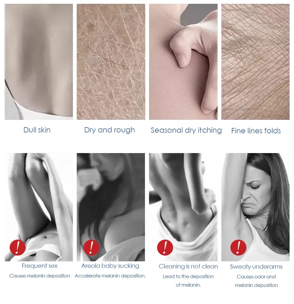 Body Whitening Cream Private Parts Underarm Bleaching Serum Whiten Butt Knee Brighten Inner Thigh Intimate Crema blanqueadora Body Whitening Cream Private Parts Underarm Bleaching Serum Whiten Butt Knee Brighten Inner Thigh Intimate Crema blanqueadora
