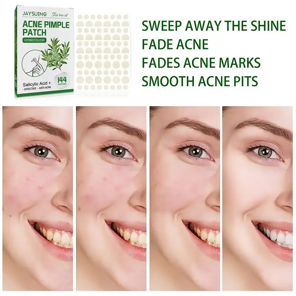 144pcs Hydrocolloid Salicylic Acid Acne Pimple Patches Treatment For Zits Blemishes Tea Tree Oil Control Redness Repair 144pcs Hydrocolloid Salicylic Acid Acne Pimple Patches Treatment For Zits Blemishes Tea Tree Oil Control Redness Repair