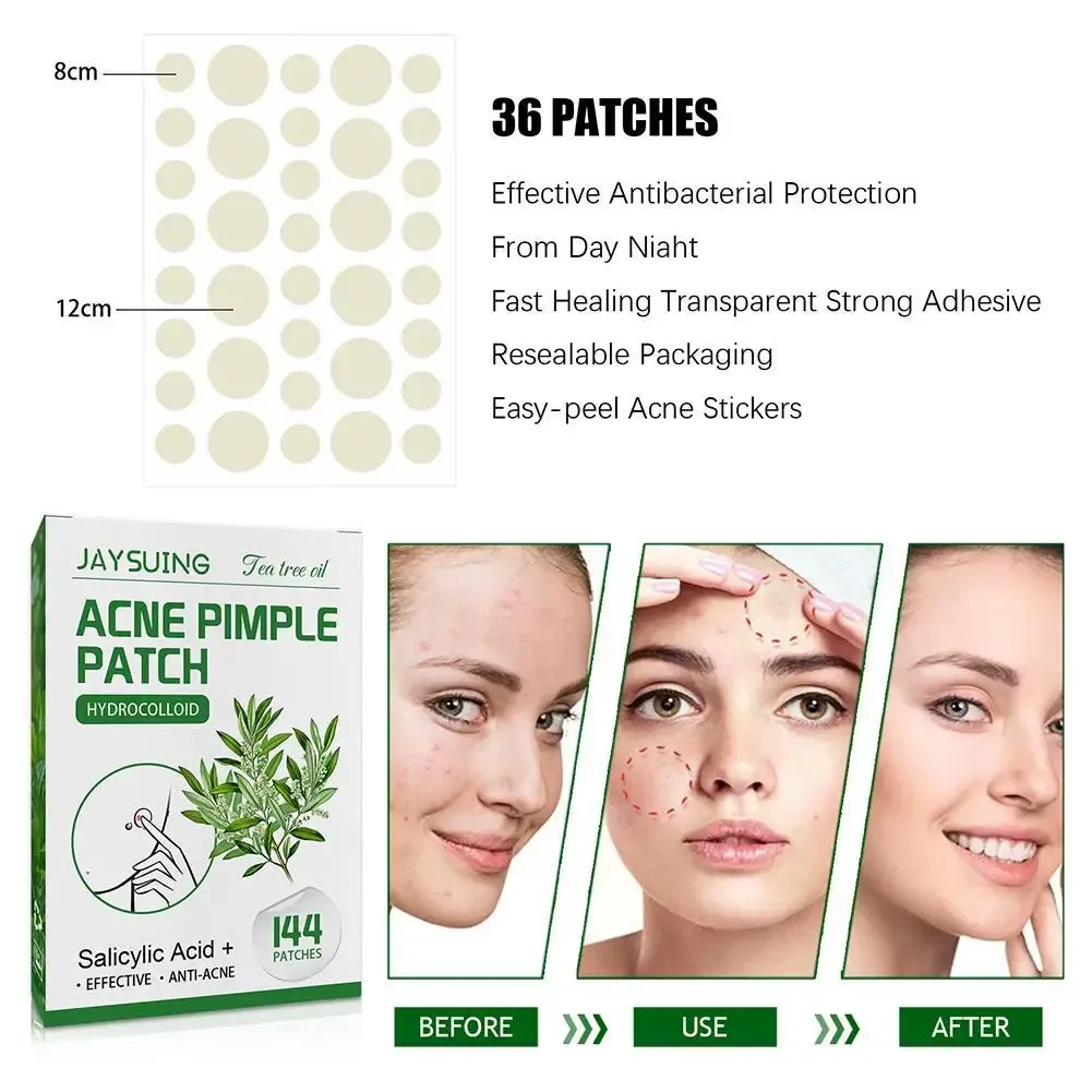 144pcs Hydrocolloid Salicylic Acid Acne Pimple Patches Treatment For Zits Blemishes Tea Tree Oil Control Redness Repair 144pcs Hydrocolloid Salicylic Acid Acne Pimple Patches Treatment For Zits Blemishes Tea Tree Oil Control Redness Repair